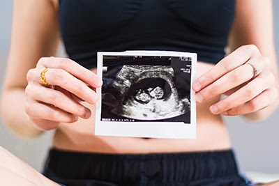 Pregnant woman holding 12 week ultrasound image