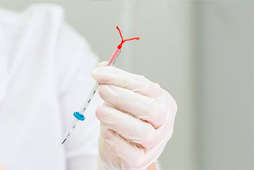 Understanding the Process of IUD Removal
